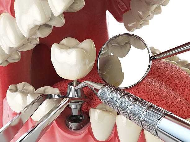 Best Emergency Dentist for Special Needs Patients in Neosho, MO